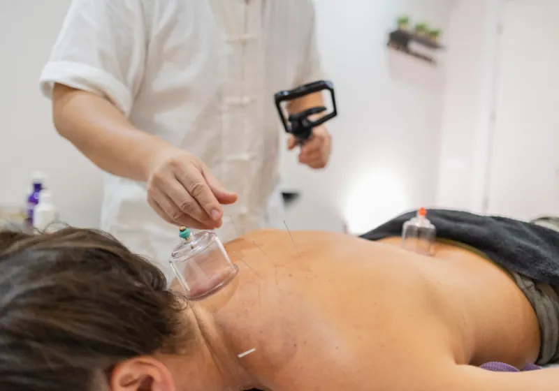 Cupping in Pickering, ON